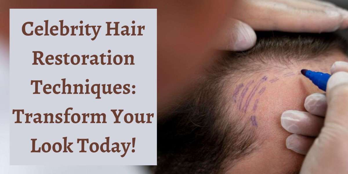 Celebrity Hair Restoration Techniques: Transform Your Look Today!